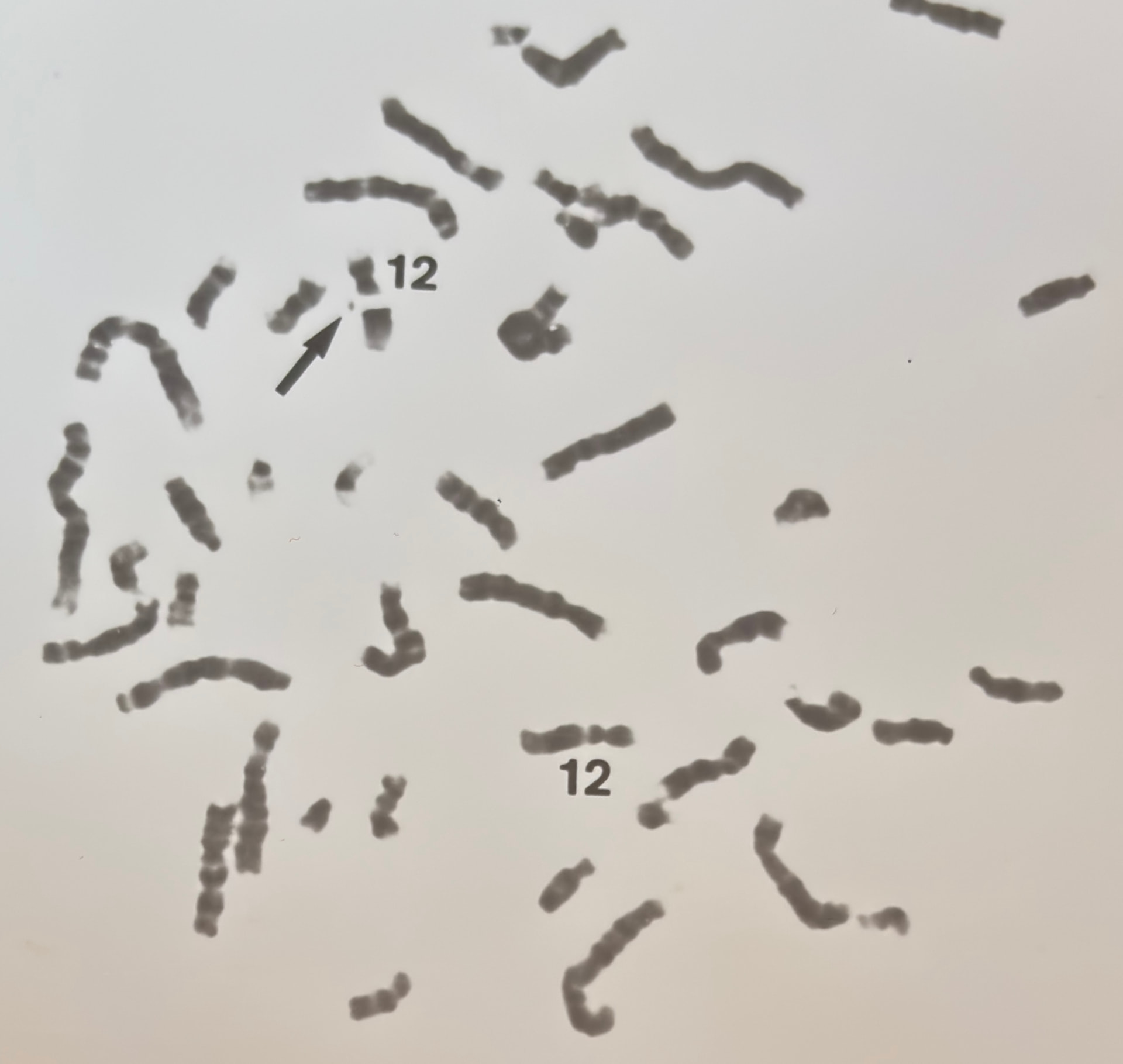 Chromosome microscopy image with chromosome 12 marked